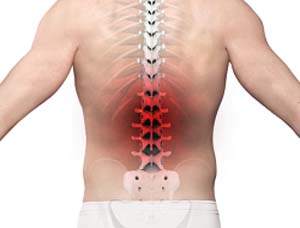 Got left flank pain in your #lowback? Or maybe #lowbackpain that wraps