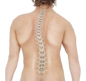 Surgery for Scoliosis