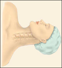 Anterior Cervical Discectomy with Fusion, Southfield Michigan