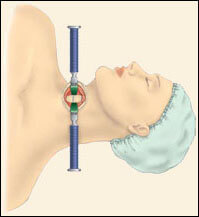 Cervical Corpectomy, Southfield Michigan